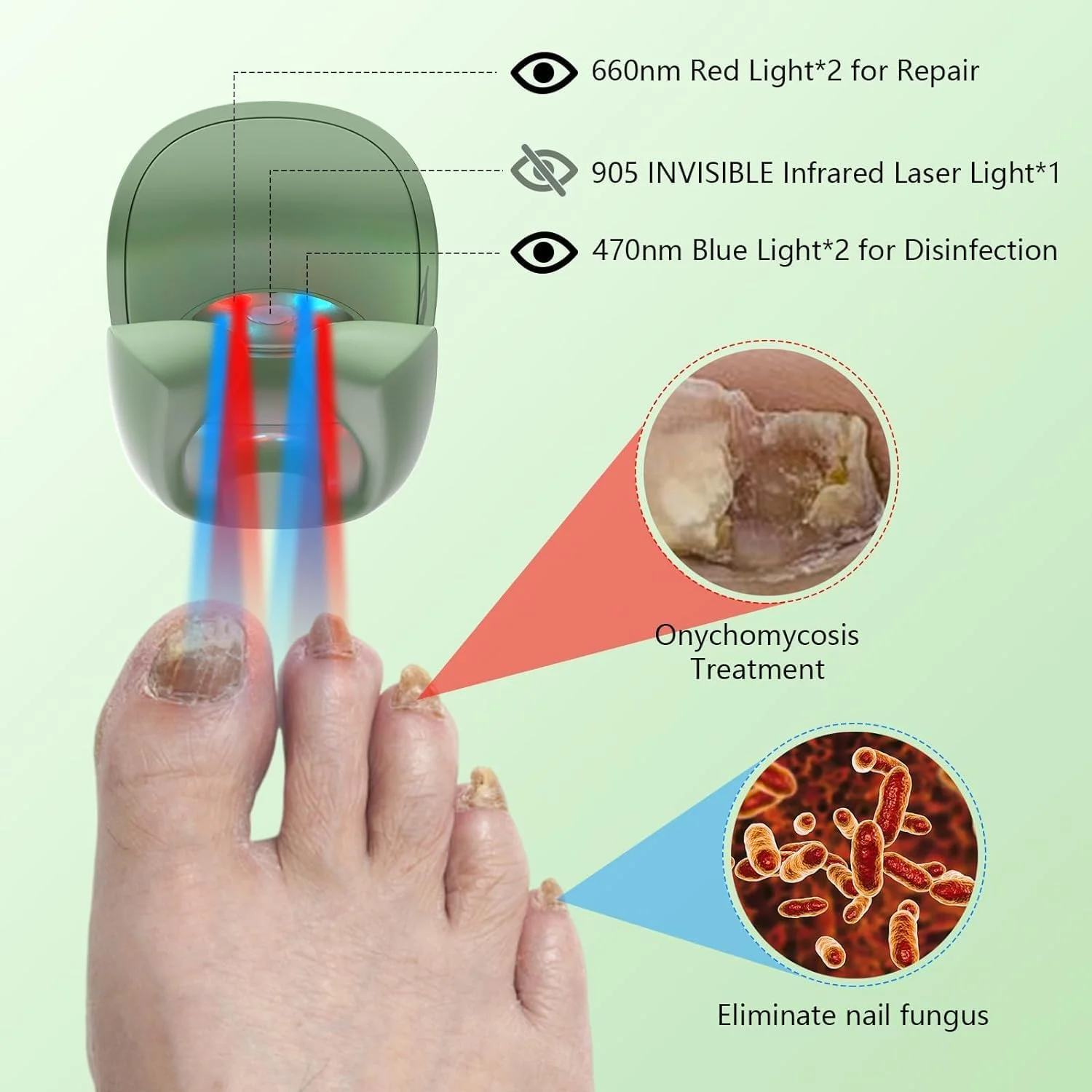 دستگاه لیزر درمان قارچ ناخن KTS، دستگاه پاک کننده لیزری قارچ برای ناخن های ضخیم، تغییر رنگ داده و آسیب دیده (470nm*2+660nm*2+905nm*1) - سبز