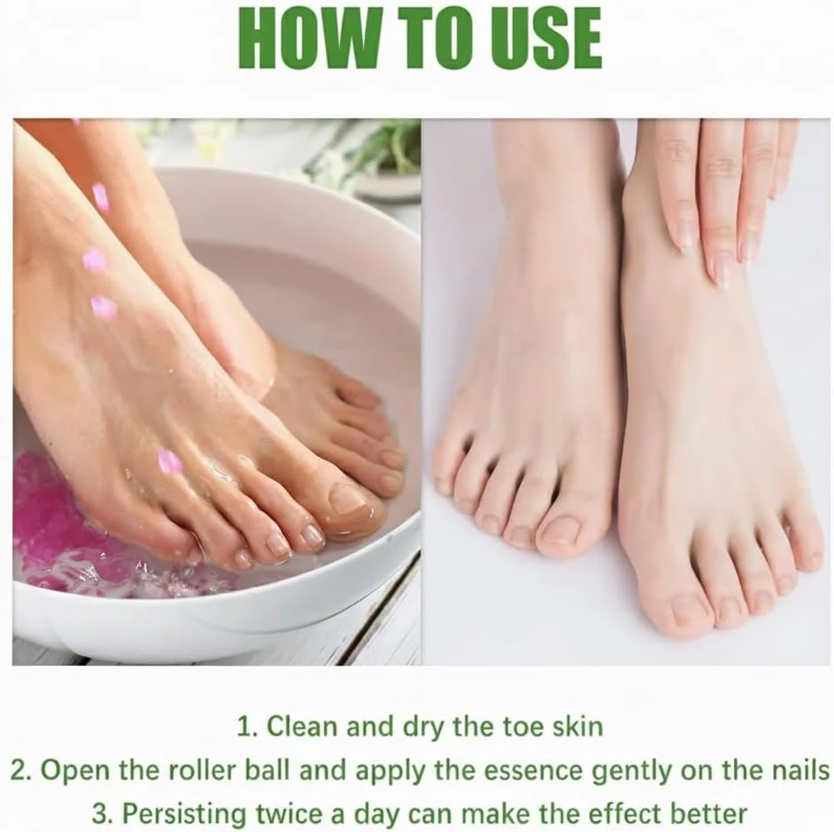 قلم مراقبت از ناخن برای روتین سلامتی - درمان قارچ ناخن با روغن درخت چای، ویتامین E و آلوئه ورا - مراقبت موثر برای عفونت قارچی (بسته 2 عددی) (متوسط)