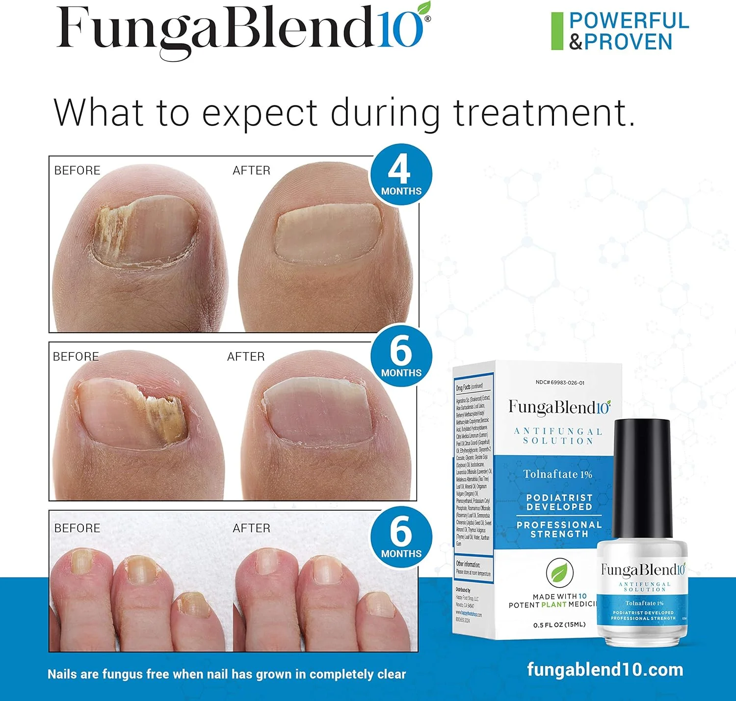 فانگا بلند 10 - داروی ضد قارچ: 1% تولنافتات و 10 داروی گیاهی - درمان قارچ ناخن پا برای ژل ترمیم ناخن، پای ورزشکاران، خارش کشاله ران، کرم حلقوی - محلول موضعی برای ناخن انگشت پا و دست