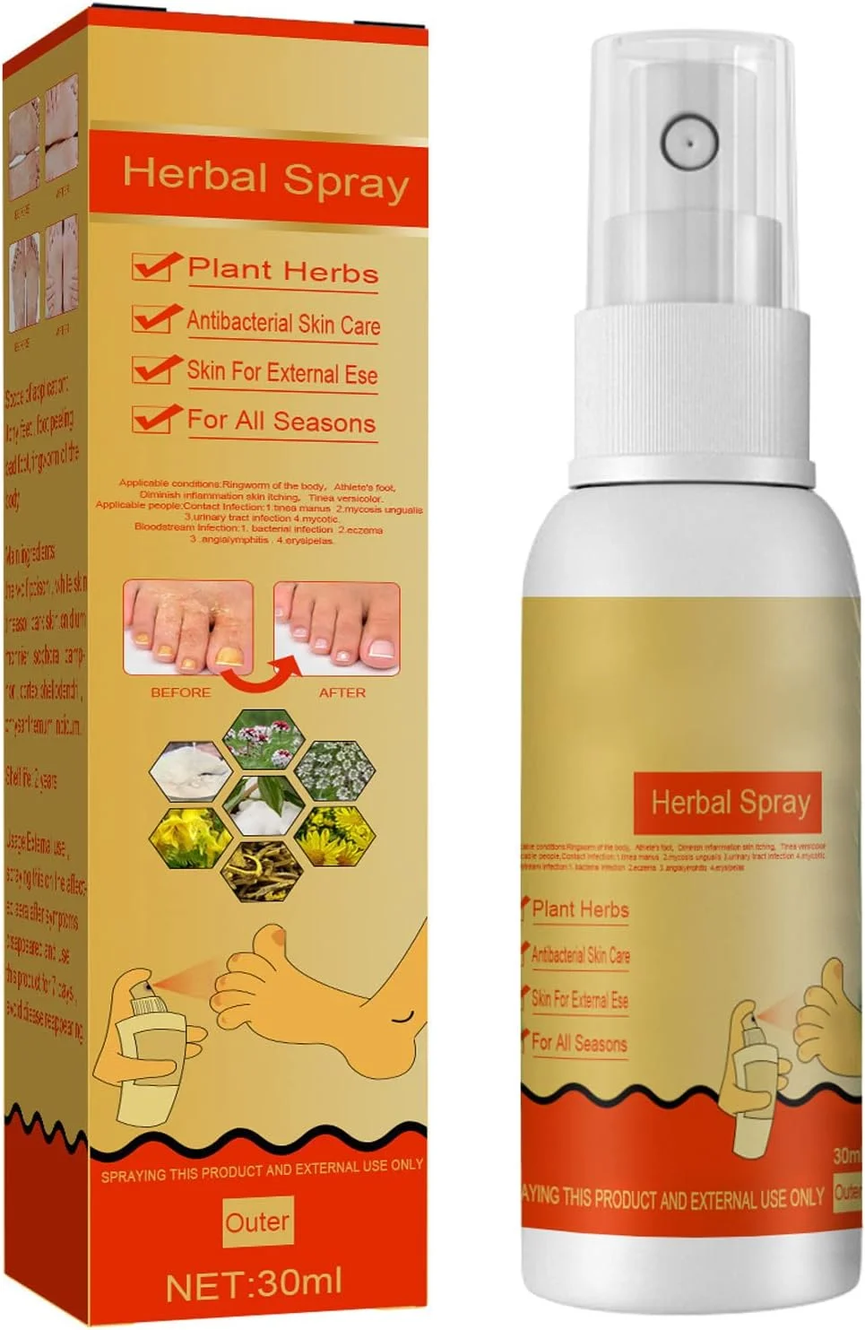 اسپری درمان پای ورزشکاران، اسپری ضد قارچ پا، اسپری مایع درمان پای ورزشکاران، خوشبو کننده پا، برای درمان درماتوفیتوزیس و رفع بوی بد