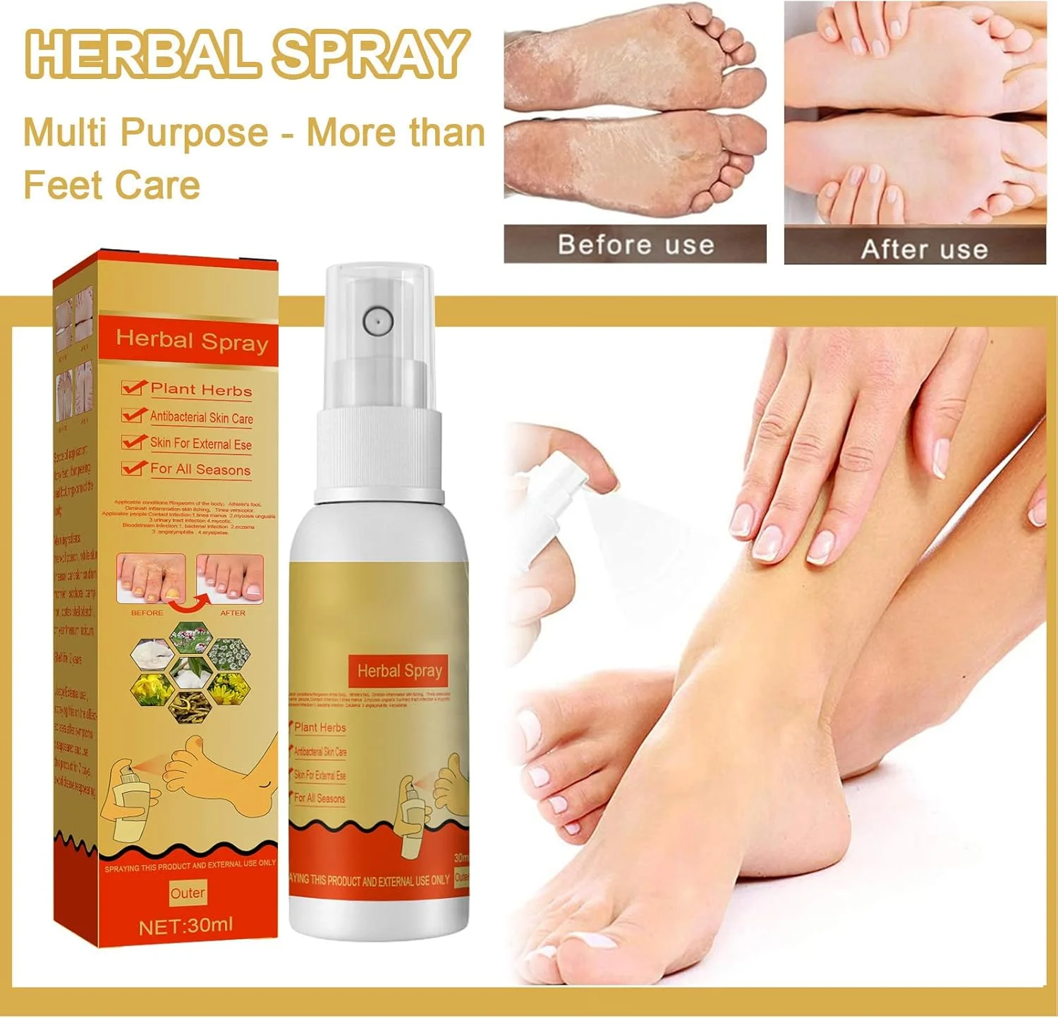 اسپری درمان پای ورزشکاران، اسپری ضد قارچ پا، اسپری مایع درمان پای ورزشکاران، خوشبو کننده پا، برای درمان درماتوفیتوزیس و رفع بوی بد اسپری درمان پای ورزشکاران، اسپری ضد قارچ پا، اسپری مایع درمان پای ورزشکاران، خوشبو کننده پا، برای درمان درماتوفیتوزیس و رفع بوی بد