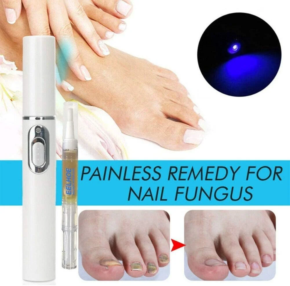 کیت درمان خانگی ضد قارچ - قلم لیزر نور آبی برای ترمیم قارچ (1 عدد قلم مراقبت از ناخن)