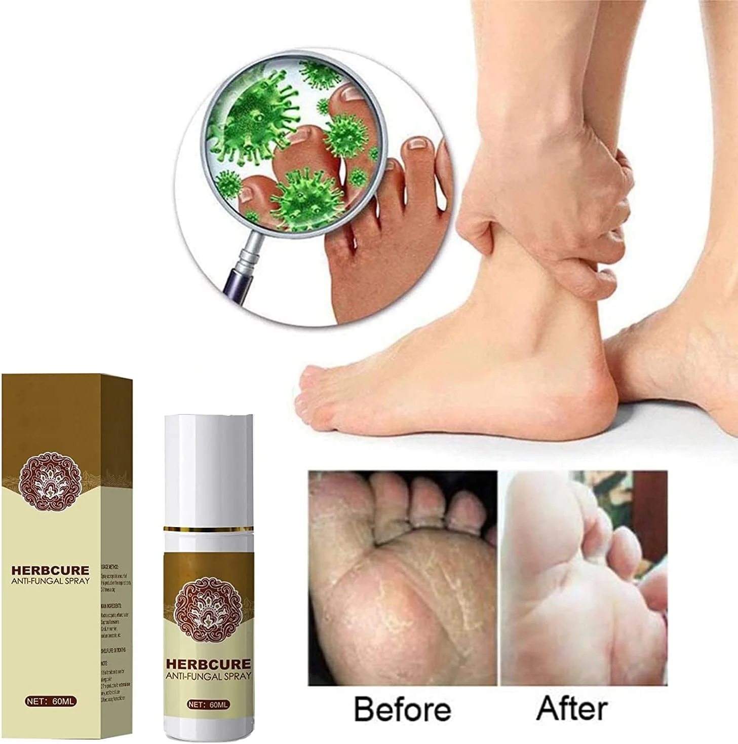 اسپری پای 60 میلی لیتری ضد قارچ، اسپری لایه بردار پا، اسپری ضد عفونت های قارچی پای ورزشکاران، جلوگیری از خارش و از بین برنده بوی پا (3 عدد)