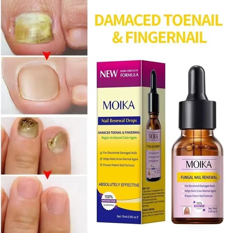 کرم ضد قارچ و ضد خارش - تسکین گیاهی ملایم برای تحریکات پوستی، تسکین سریع خارش صورت و بدن، کمک به اگزما و عفونت قارچی ناخن