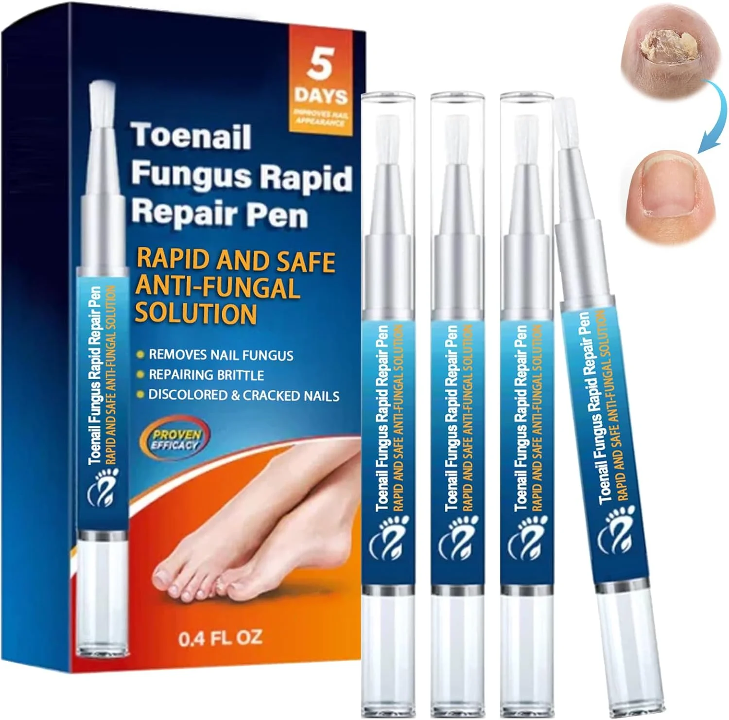 مجموعه ۴ عددی قلم مراقبت از ناخن، قلم ترمیم ناخن آسیب دیده، ترمیم ناخن، قلم ترمیم ناخن، ترمیم ناخن پا برای ناخن های شکسته، کاهش تغییر رنگ، ترمیم ناخن سالم، کمک به بهبود ظاهر ناخن