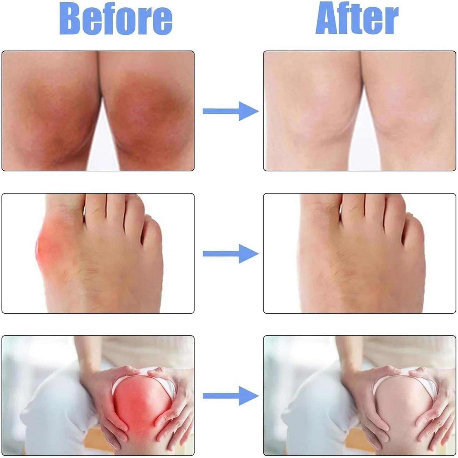 اسپری تسکین درد مفاصل، 2 عدد اسپری ترمیم کننده و تسکین دهنده درد مفاصل، اسپری تسکین درد مفاصل گیاهی طبیعی، اسپری تسکین سریع درد مفاصل